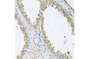 Immunohistochemistry of paraffin-embedded human prostate using HSP90AA1 antibody (ABIN6292998) at dilution of 1:100 (40x lens). (HSP90AA1 Antikörper)