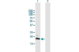 Western Blot analysis of GUCA1C expression in transfected 293T cell line by GUCA1C MaxPab polyclonal antibody. (GUCA1C Antikörper  (AA 1-209))