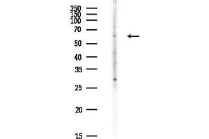 anti-Coiled-Coil Domain Containing 181 (CCDC181) antibody
