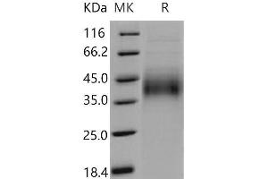 Western Blotting (WB) image for Growth Hormone Receptor (GHR) (Active) protein (His tag) (ABIN7320418) (Growth Hormone Receptor Protein (GHR) (His tag))