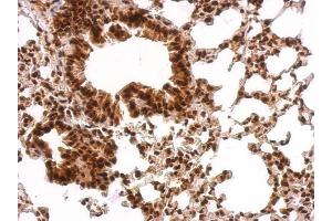 Immunohistochemistry (IHC) image for anti-Growth Factor Receptor-Bound Protein 2 (GRB2) (C-Term) antibody (ABIN2854697)
