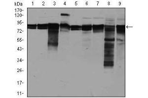 Western blot analysis using EIF4B mouse mAb against A549 (1), A431 (2), HepG2 (3), HEK293 (4), HeLa (5), Jurkat (6), K562 (7), NIH3T3 (8), and MCF-7 (9) cell lysate. (EIF4B Antikörper)