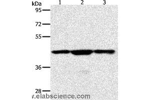 Western blot analysis of Jurkat, hela and K562 cell, using MAP2K1 Polyclonal Antibody at dilution of 1:400 (MEK1 Antikörper)