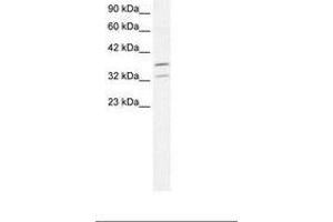 Image no. 1 for anti-Forkhead Box L1 (FOXL1) (N-Term) antibody (ABIN202292) (FOXL1 Antikörper  (N-Term))