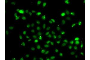 Immunofluorescence analysis of A549 cell using BCL6 antibody. (BCL6 Antikörper)