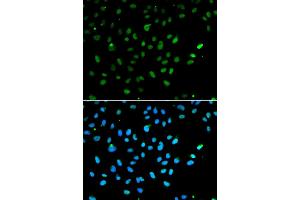 Immunofluorescence analysis of A549 cells using SMARCA4 antibody. (SMARCA4 Antikörper)