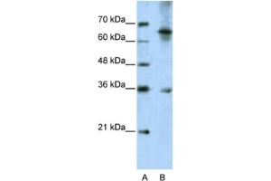 Western Blotting (WB) image for anti-Wingless-Type MMTV Integration Site Family, Member 9B (WNT9B) antibody (ABIN2462373)
