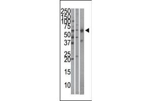 The anti-Importin alpha-3 Pab (ABIN388688 and ABIN2838720) is used in Western blot to detect Importin alpha-3 in Hela (left), mouse brain (middle), and HepG2 (right)cell line/tissue lysates. (KPNA4 Antikörper  (C-Term))