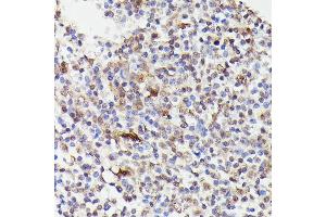 Immunohistochemistry (IHC) image for anti-Cell Division Cycle 23 (CDC23) (AA 50-150) antibody (ABIN7266248)
