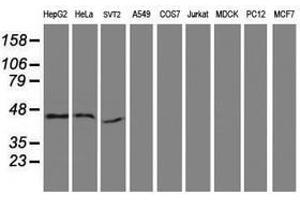 Image no. 2 for anti-serpin Peptidase Inhibitor, Clade B (Ovalbumin), Member 13 (SERPINB13) antibody (ABIN1500879) (SERPINB13 Antikörper)