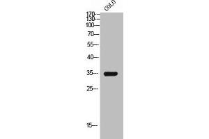 Western Blot analysis of COLO cells using GPR119 Polyclonal Antibody (G Protein-Coupled Receptor 119 Antikörper  (Internal Region))