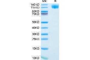 Oncostatin M Receptor Protein (OSMR) (AA 28-740) (His tag)