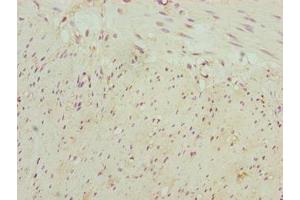 Immunohistochemistry of paraffin-embedded human colon tissue using ABIN7161250 at dilution of 1:100 (NBPF3 Antikörper  (AA 1-252))