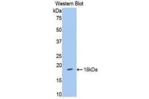 Western Blotting (WB) image for anti-Hexokinase 1 (HK1) (AA 676-800) antibody (ABIN1859173) (Hexokinase 1 Antikörper  (AA 676-800))