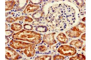 Immunohistochemistry of paraffin-embedded human kidney tissue using ABIN7152544 at dilution of 1:100 (FANCC Antikörper  (AA 1-210))