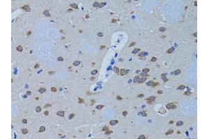Immunohistochemistry of paraffin-embedded rat brain using PLCB1 antibody (ABIN1874160) at dilution of 1:100 (40x lens). (Phospholipase C beta 1 Antikörper)