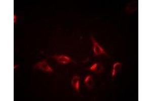 Immunofluorescent analysis of BCLG staining in Hela cells.