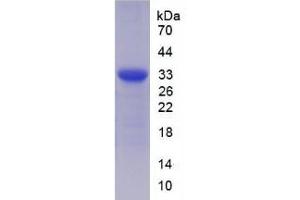 Image no. 1 for Amyloid beta (A4) Precursor-Like Protein 2 (APLP2) (AA 607-852) protein (His tag) (ABIN1080873) (APLP2 Protein (AA 607-852) (His tag))