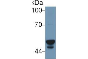 Western blot analysis of Human Liver lysate, using Human CYP3A7 Antibody (1 µg/ml) and HRP-conjugated Goat Anti-Rabbit antibody ( (CYP3A7 Antikörper  (AA 344-497))