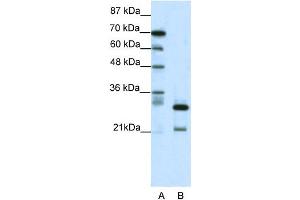WB Suggested Anti-HMOX2 Antibody Titration: 0. (HMOX2 Antikörper  (N-Term))