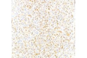 Immunohistochemistry (IHC) image for anti-Valosin Containing Protein (VCP) (C-Term) antibody (ABIN7452151)