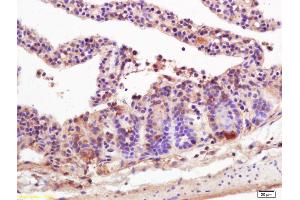 Formalin-fixed and paraffin embedded mouse intestine labeled with Anti-MICA/MHC I a Polyclonal Antibody, Unconjugated (ABIN728788) at 1:200 followed by conjugation to the secondary antibody and DAB staining. (MICA Antikörper  (AA 120-170))