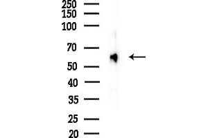 Western blot analysis of lysates from Mouse brain, using CACN Antibody at 1/1000 dilution.