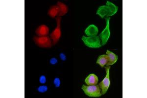 staining Hela cells(30 min of UV treatment) by IF/ICC. (CCDC99 Antikörper  (C-Term))