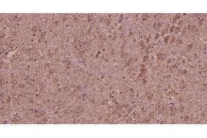 Paraformaldehyde-fixed, paraffin embedded rat brain, Antigen retrieval by boiling in sodium citrate buffer (pH6) for 15min, Block endogenous peroxidase by 3% hydrogen peroxide for 30 minutes, Blocking buffer (normal goat serum) at 37°C for 20min, Antibody incubation with Progestin Receptor Beta/MPRB Antibody at 1:400 overnight at 4°C, followed by a conjugated secondary and DAB staining. (Progestin Receptor beta/mprb (AA 251-300) Antikörper)