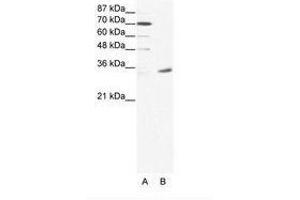 Image no. 1 for anti-Melanoma Antigen Family A, 9 (MAGEA9) (N-Term) antibody (ABIN202005) (MAGEA9 Antikörper  (N-Term))