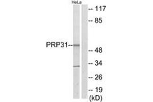 Western Blotting (WB) image for anti-Pre-mRNA Processing Factor 31 (PRPF31) (AA 331-380) antibody (ABIN2889696) (PRPF31 Antikörper  (AA 331-380))
