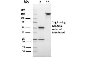 SDS-PAGE Analysis Purified C1QB Mouse Monoclonal Antibody (C1QB/2966). (C1QB Antikörper  (AA 41-188))