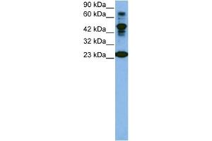 WB Suggested Anti-CDK2 Antibody Titration:  1 ug/ml  Positive Control:  Jurkat cell lysate CDK2 is strongly supported by BioGPS gene expression data to be expressed in Human Jurkat cells (CDK2 Antikörper  (C-Term))