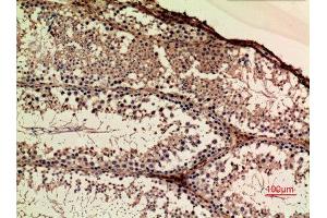 Immunohistochemistry (IHC) image for anti-Amyloid beta (A4) Precursor-Like Protein 1 (APLP1) (Internal Region) antibody (ABIN6283509)