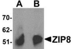 Western blot analysis of ZIP8 in human spleen tissue lysate with ZIP8 antibody at (A) 1 and (B) 2 μg/ml. (SLC39A8 Antikörper  (C-Term))