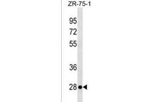 KLRF2 Antibody (N-term) (ABIN1539283 and ABIN2850223) western blot analysis in ZR-75-1 cell line lysates (35 μg/lane). (KLRF2 Antikörper  (N-Term))