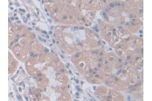 Immunohistochemistry (IHC) image for anti-Phosphoglucomutase 1 (PGM1) (AA 1-235) antibody (ABIN7444190)