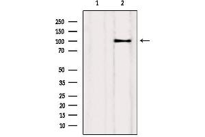 Western blot analysis of extracts from Myeloma cells, using Drebrin Antibody. (DBN1 Antikörper  (Internal Region))