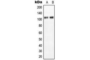 Western blot analysis of NGEP expression in MCF7 (A), NIH3T3 (B) whole cell lysates. (Anoctamin 7 Antikörper  (C-Term))