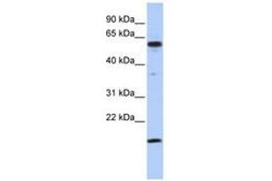 Image no. 1 for anti-Thyroid Hormone Receptor Interactor 10 (TRIP10) (C-Term) antibody (ABIN6742770) (TRIP10 Antikörper  (C-Term))