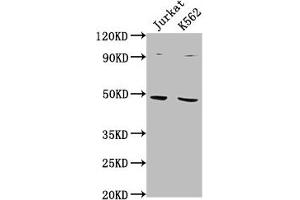 Western Blot Positive WB detected in: Jurkat whole cell lysate, K562 whole cell lysate All lanes: PSMD6 antibody at 1:2000 Secondary Goat polyclonal to rabbit IgG at 1/50000 dilution Predicted band size: 46, 42, 52 kDa Observed band size: 46 kDa (PSMD6 Antikörper  (Regulatory Subunit 6))