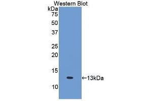 Western Blotting (WB) image for anti-Interleukin 6 Receptor (IL6R) (AA 385-462) antibody (ABIN3206018) (IL-6 Receptor Antikörper  (AA 385-462))