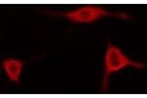 ABIN6278550 staining Hela cells by IF/ICC. (AIFM2 Antikörper  (Internal Region))