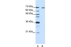 WB Suggested Anti-FZD7 Antibody Titration:  0.