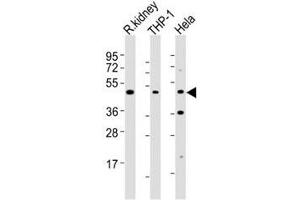 Western blot testing of BMP2 antibody at 1:2000 dilution. (BMP2 Antikörper)