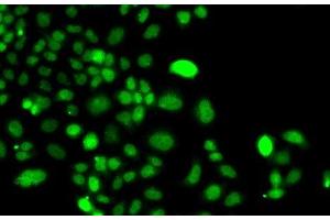 Immunofluorescence analysis of A549 cells using PIP4K2A Polyclonal Antibody (PIP4K2A Antikörper)