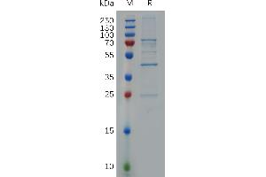 SDS-PAGE (SDS) image for Hydroxysteroid (17-Beta) Dehydrogenase 10 (HSD17B10) (AA 2-261) protein (S tag) (ABIN7490903)