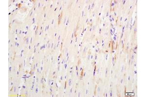 Formalin-fixed and paraffin embedded mouse heart labeled with Anti-ATP4B Polyclonal Antibody, Unconjugated (ABIN740205) at 1:200 followed by conjugation to the secondary antibody and DAB staining. (ATP4b Antikörper  (AA 201-291))