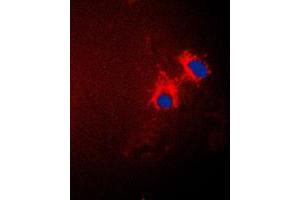 Immunofluorescent analysis of p15 INK4b staining in A549 cells. (CDKN2B Antikörper  (C-Term))
