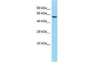 WB Suggested Anti-Jakmip1 Antibody   Titration: 1. (JAKMIP1 Antikörper  (N-Term))